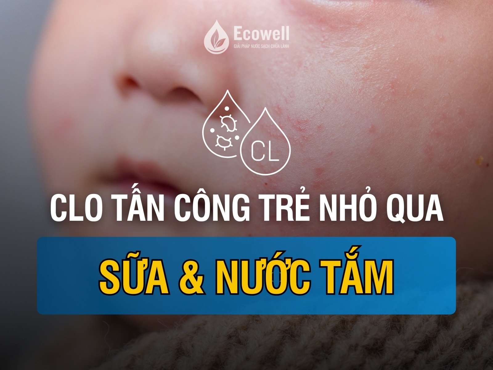 Trẻ nhỏ & sơ sinh có thể bị clo dư tấn công qua sữa và nước tắm?