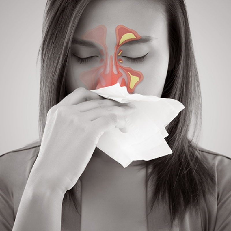 Viêm mũi dị ứng